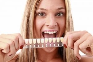 A Plus Dental | Porcelain Veneers | Dentist Campbelltown