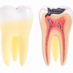 A Plus Dental | Dental Abscess | Dentist Campbelltown