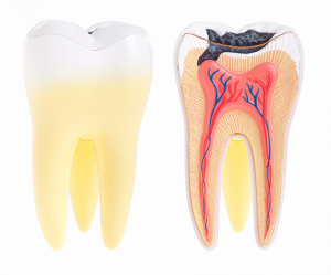 A Plus Dental | Dental Abscess | Dentist Campbelltown