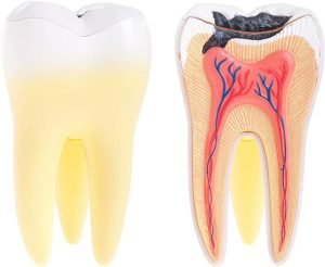 A Plus Dental | Tooth Decay | Dentist Campbelltown