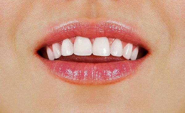 6 Effective Ways To Get Healthy White Teeth