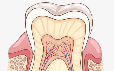 Root Canal Treatment – Key Signs You May Need It
