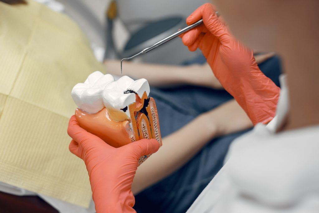 root canal treatment key signs you may need it