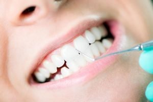 Gum Disease Treatment | Dentist Campbelltown