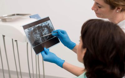 Campbelltown Dental X-Rays: The Key to Catching Oral Problems Before They Start