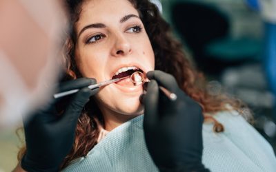 Guide to Dental Fillings at A Plus Dental