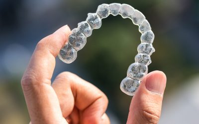 Dental Tips: The Top 5 Benefits of Invisalign