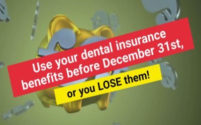 Dental Insurance Benefits: Use it or Lose it! | A Plus Dental