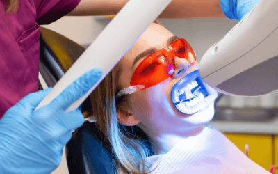 Teeth Whitening in Campbelltown: Professional Options That Work